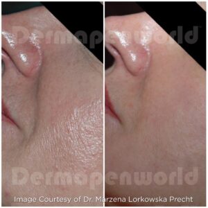 Aging Skin Treatment